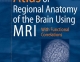 Atlas of Regional ANATOMY of the Brain Using MRI 