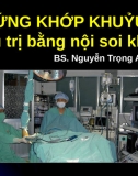 Cứng Khớp Khuỷu Điều Trị Bằng Nội Soi Khớp 